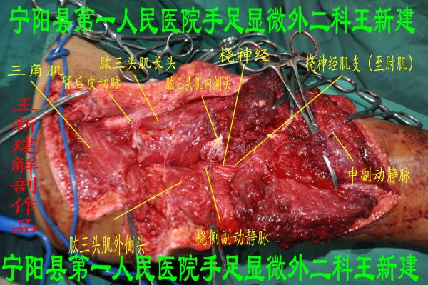 左上臂背侧图_conew1.jpg