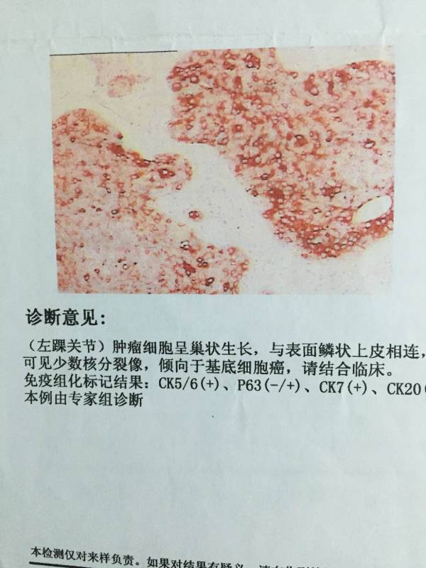 病理报告