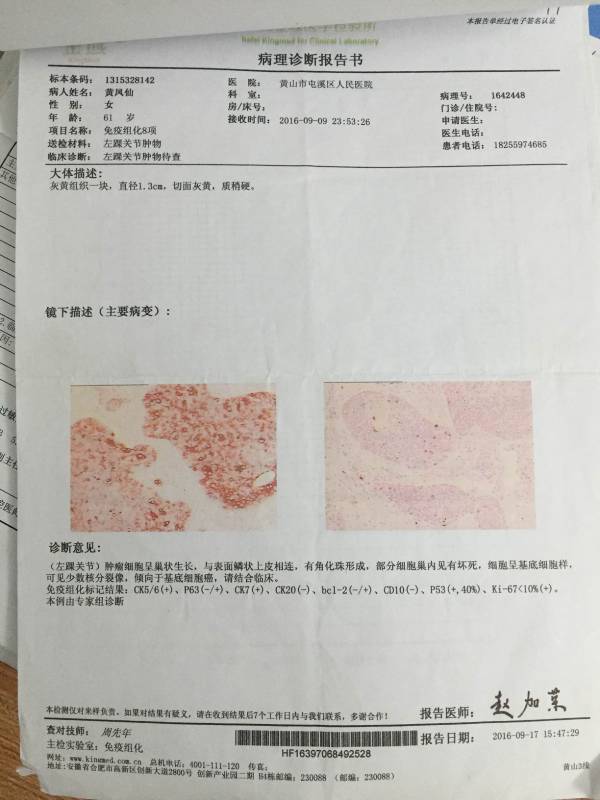 病理报告