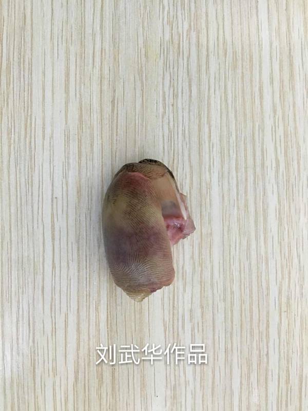 离断拇指情况