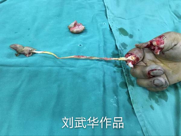术中照